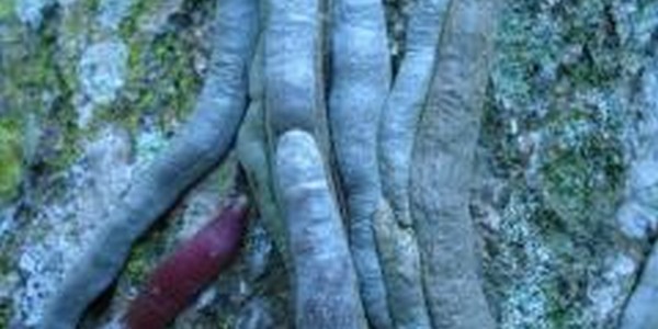 ماجستير العلوم في علم الطفيليات الطبية عن طريق البحث