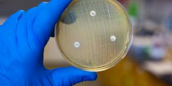 ماجستير في العلوم في التكنولوجيا الحيوية الميكروبية عن طريق البحث